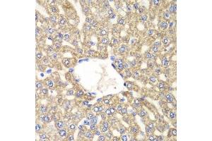 Immunohistochemistry of paraffin-embedded rat liver using ALDH2 antibody.