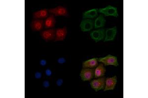 ABIN6254999 and ABIN6267500 staining HepG2 cells(4h of LPS treatment) by IF/ICC. (BRCA1 anticorps  (pSer1524))