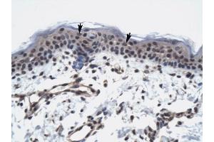 TAF9 antibody was used for immunohistochemistry at a concentration of 4-8 ug/ml to stain Squamous epithelial cells (arrows) in Human Skin.