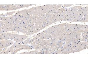 Detection of MYOC in Human Cardiac Muscle Tissue using Polyclonal Antibody to Myocilin (MYOC)
