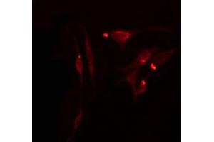 ABIN6275074 staining  Hela cells by IF/ICC.