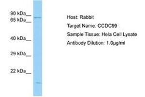 Image no. 1 for anti-Protein Spindly (SPDL1) (C-Term) antibody (ABIN6750167) (Spindly anticorps  (C-Term))