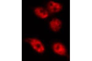 ABIN6268811 staining HeLa by IF/ICC. (RBMX anticorps  (N-Term))