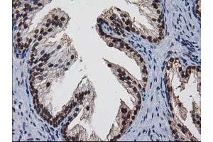 Image no. 3 for anti-Nonhomologous End-Joining Factor 1 (NHEJ1) antibody (ABIN1499728)