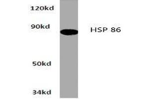 Image no. 1 for anti-Heat Shock Protein 90kDa alpha (Cytosolic), Class A Member 1 (HSP90AA1) antibody (ABIN265473) (HSP90AA1 anticorps)