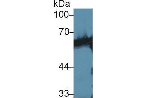 Western Blot; Sample: Mouse Skeletal muscle lysate; Primary Ab: 1µg/ml Rabbit Anti-Human CaN Antibody Second Ab: 0. (CAN anticorps  (AA 7-301))