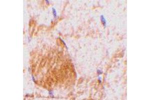 Immunohistochemistry of Il31 in rat skeletal muscle tissue with Il31 polyclonal antibody  at 10 ug/mL . (IL-31 anticorps  (N-Term))