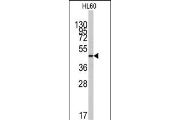 ZIC3 anticorps  (N-Term)