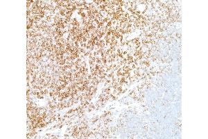 Immunohistochemistry (IHC) image for anti-CD5 (CD5) (AA 445-495) antibody (ABIN7454003) (Recombinant CD5 anticorps  (AA 445-495))