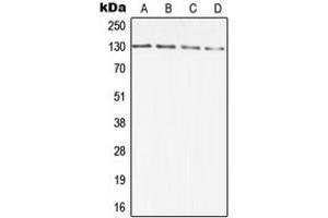 Western blot analysis of DIAPH2 expression in A431 (A), HCT116 (B), SP2/0 (C), PC12 (D) whole cell lysates. (DIAPH2 anticorps  (Center))