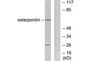 Western blot analysis of extracts from LOVO cells, using Osteopontin Antibody. (Osteopontin anticorps  (AA 261-310))