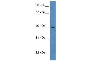 WB Suggested Anti-ZNF821 Antibody Titration:  0. (ZNF821 anticorps  (N-Term))
