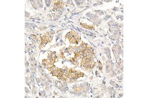 Immunohistochemistry of paraffin-embedded Human islet using CD99 Rabbit pAb (ABIN3022730, ABIN3022731, ABIN3022732, ABIN1512728 and ABIN6219199) at dilution of 1:50 (40x lens). (CD99 anticorps  (AA 23-185))