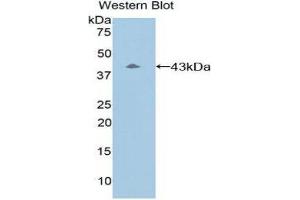 Western Blotting (WB) image for anti-Complement Component 8, beta Polypeptide (C8B) (AA 161-503) antibody (ABIN1858200) (C8B anticorps  (AA 161-503))