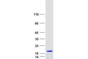 Validation with Western Blot