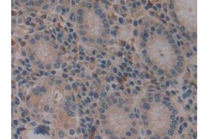 DAB staining on IHC-P; Samples: Human Stomach Tissue