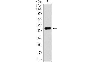 Western blot analysis using ACLY mAb against human ACLY recombinant protein. (ACLY anticorps  (AA 306-502))