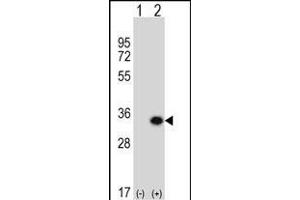 Western blot analysis of GCLM (arrow) using rabbit polyclonal GCLM Antibody (C-term) (ABIN653046 and ABIN2842657). (GCLM anticorps  (C-Term))
