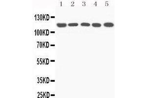 Western Blotting (WB) image for anti-Complement Component 5 (C5) (AA 1-18), (N-Term) antibody (ABIN3044294) (C5 anticorps  (N-Term))