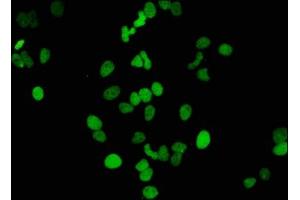 anti-Histone H3.1 (HIST1H3B) (H3K14ac) antibody