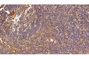Detection of IL8 in Porcine Lymph node Tissue using Polyclonal Antibody to Interleukin 8 (IL8) (IL-8 anticorps  (AA 23-101))