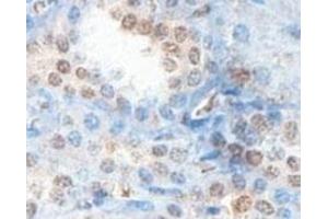 Immunohistochemical analysis of paraffin-embedded human fetal kidney showing cytoplasmic staining with ABHD12B polyclonal antibody  at a 1 : 100 dilution. (ABHD12B anticorps  (AA 78-284))