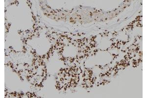 ABIN6277110 at 1/100 staining Rat lung tissue by IHC-P. (TYK2 anticorps  (C-Term))