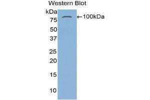 Detection of Recombinant TGM2, Human using Polyclonal Antibody to Transglutaminase 2 (TGM2)