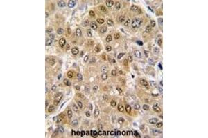 Immunohistochemistry (IHC) image for anti-DEAD (Asp-Glu-Ala-Asp) Box Polypeptide 5 (DDX5) (AA 491-518) antibody (ABIN3003228)
