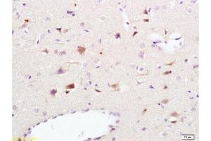 Formalin-fixed and paraffin embedded rat brain tissue labeled Anti-NCAM1 Polyclonal Antibody, Unconjugated  at 1:200, followed by conjugation to the secondary antibody and DAB staining (CD56 anticorps  (AA 701-800))