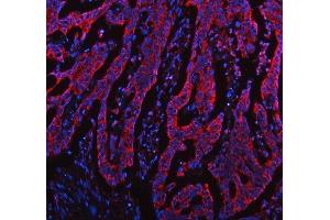 IF analysis of TOMM20 using anti-TOMM20 antibody (ABIN7600883). (TOMM20 anticorps  (AA 25-145))