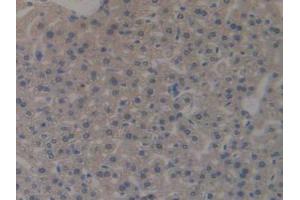 IHC-P analysis of Mouse Liver Tissue, with DAB staining. (MUC1 anticorps  (AA 474-630))