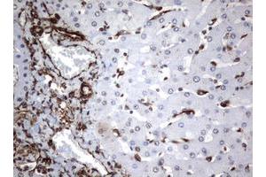 Image no. 5 for anti-Vimentin (VIM) (AA 210-466) antibody (ABIN1491200)