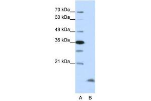 Western Blot showing CCNB3 antibody used at a concentration of 1-2 ug/ml to detect its target protein. (Cyclin B3 anticorps  (N-Term))