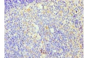 Immunohistochemistry of paraffin-embedded human tonsil tissue using ABIN7176253 at dilution of 1:100 (ZNF346 anticorps  (AA 1-294))