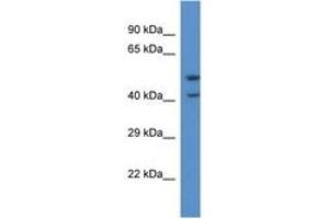 Image no. 1 for anti-Pyroglutamylated RFamide Peptide Receptor (QRFPR) (C-Term) antibody (ABIN6746840) (QRFPR anticorps  (C-Term))