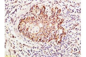 Formalin-fixed and paraffin embedded human skin labeled with Anti-RhoA Polyclonal Antibody , Unconjugated 1:400 followed by conjugation to the secondary antibody and DAB staining (RhoA, C (AA 101-193) anticorps)