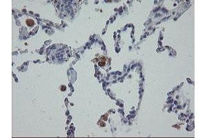 Image no. 9 for anti-Mitochondrial Ribosomal Protein S27 (MRPS27) (AA 151-414) antibody (ABIN1490963)