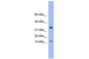 WB Suggested Anti-GABARAP Antibody Titration: 0. (GABARAP anticorps  (C-Term))