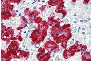 Human Adrenal (formalin-fixed, paraffin-embedded) stained with VAMP2 antibody ABIN364330 at 10 ug/ml followed by biotinylated anti-mouse IgG secondary antibody ABIN481714, alkaline phosphatase-streptavidin and chromogen.