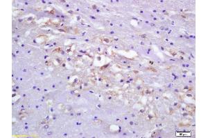 Formalin-fixed and paraffin embedded rat brain tissue labeled Anti-Ets1/ETS-1 Polyclonal Antibody, Unconjugated (ABIN674424) at 1:200, followed by conjugation to the secondary antibody and DAB staining