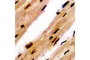 Immunohistochemical analysis of PSMB8 staining in rat heart formalin fixed paraffin embedded tissue section. (PSMB8 anticorps)