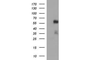 Western Blotting (WB) image for anti-Tubulin, alpha 1B (TUBA1B) antibody (ABIN2715958) (TUBA1B anticorps)