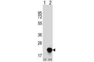 Western blot analysis of RNF5 (arrow) using rabbit polyclonal RNF5 Antibody (Center) .
