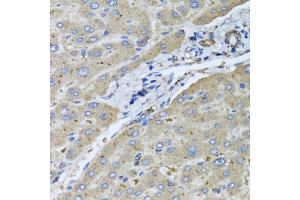 Immunohistochemistry of paraffin-embedded human liver injury using UGT2B10 antibody.