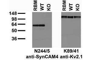 anti-Cell Adhesion Molecule 4 (CADM4) (AA 1-321), (Extracellular), (N-Term), (Signal Peptide) antibody