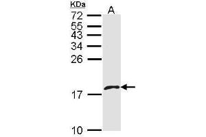 WB Image Sample (30 ug of whole cell lysate) A: A431 , 15% SDS PAGE antibody diluted at 1:1000 (PF4V1 anticorps  (C-Term))