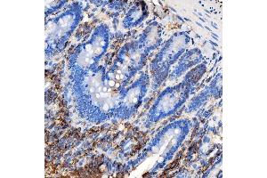 IHC analysis of RAB7/RAB7A using anti-RAB7/RAB7A antibody (ABIN7600597). (RAB7A anticorps  (AA 21-177))