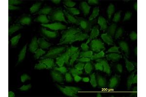 Immunofluorescence of monoclonal antibody to GJB3 on HeLa cell.