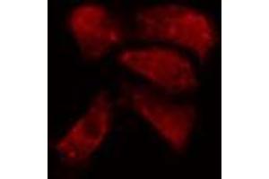 ABIN6274152 staining A549 cells by IF/ICC. (Histone H1 anticorps  (Internal Region))